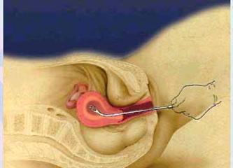 成都做睡眠麻醉人流技术好的医院